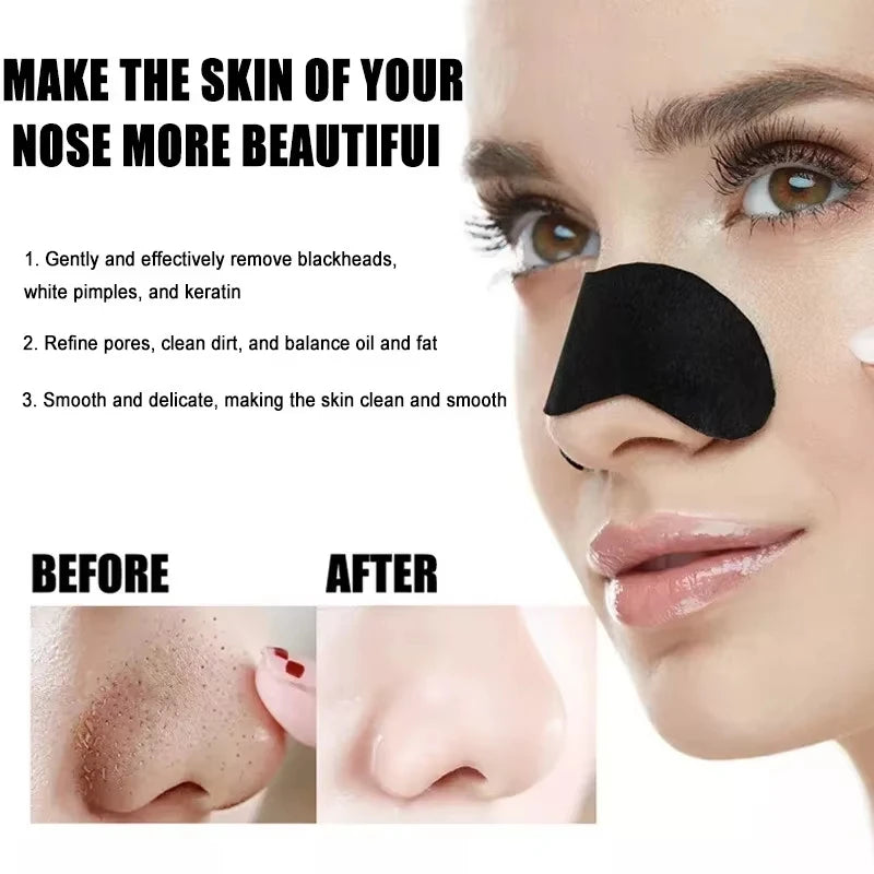 10/50/100 Pieces Deep Cleansing Blackhead Remover Patches - Effective Nose Spots Facial Spot Cleansing for Blackheads and Pores